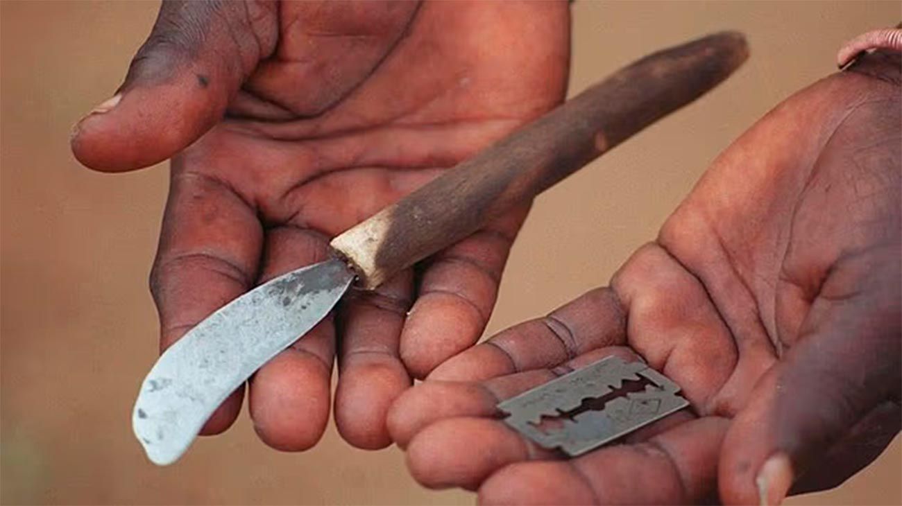 El ritual ancestral de circuncisión dejó 39 muertos y decenas de mutilados en Sudáfrica