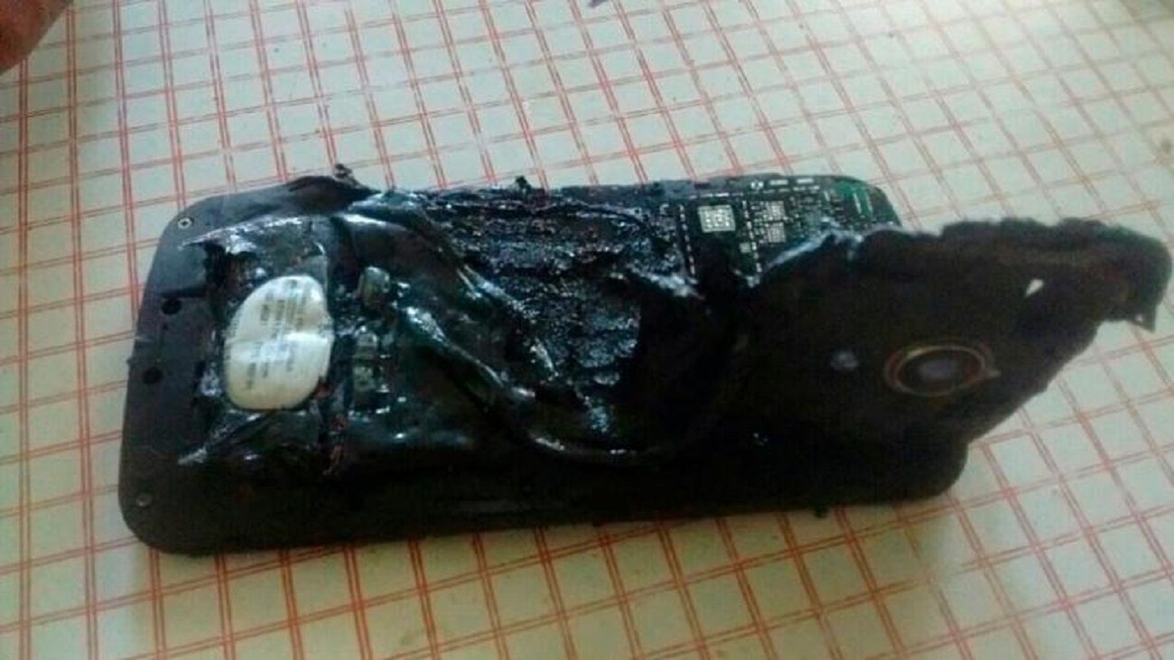 Le explotó su celular mientras dormía y sufrió quemaduras en todo el cuerpo