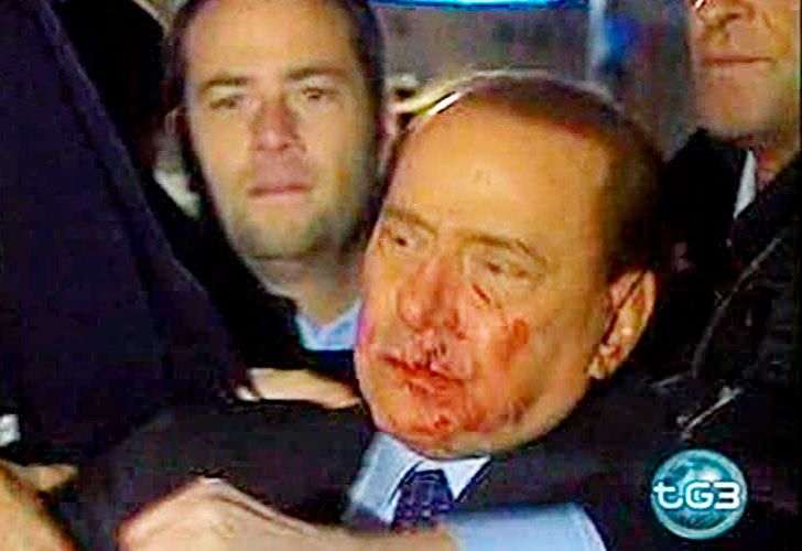 Berlusconi está más grave de lo que se creía
