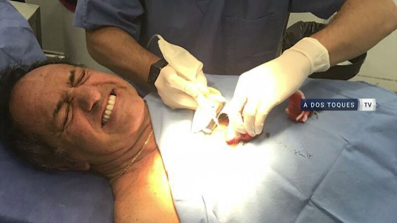 Daniel Scioli se lesionó en un partido de futsal y fue operado en un hospital