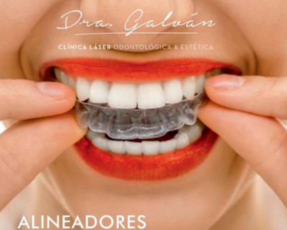 No hay obstaculos para tener una sonrisa Perfecta
