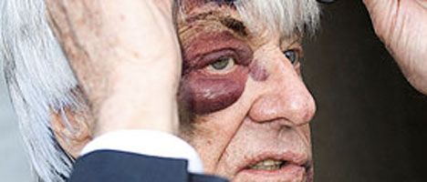 Así quedó el rostro de Bernie Ecclestone tras el robo