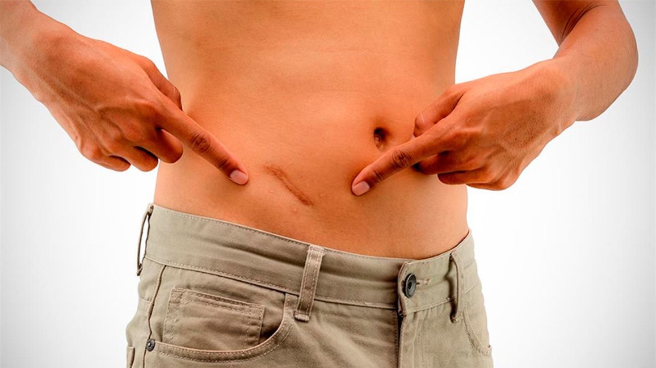 Las 9 partes del cuerpo humano que no sirven para nada