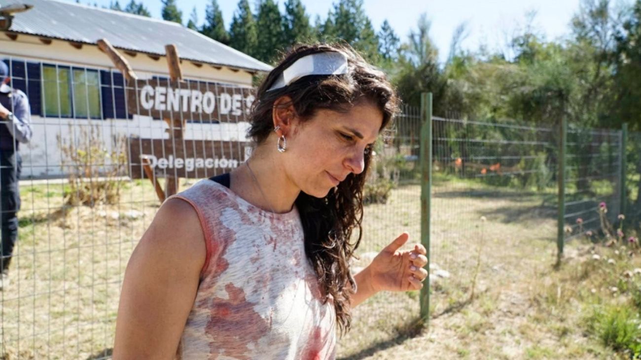 Celeste Fierro: "Los que golpearon funcionan como la patota de Joe Lewis"