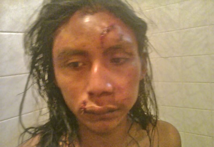 Golpearon brutalmente al hijo de Félix Díaz y a otro joven qom en Formosa