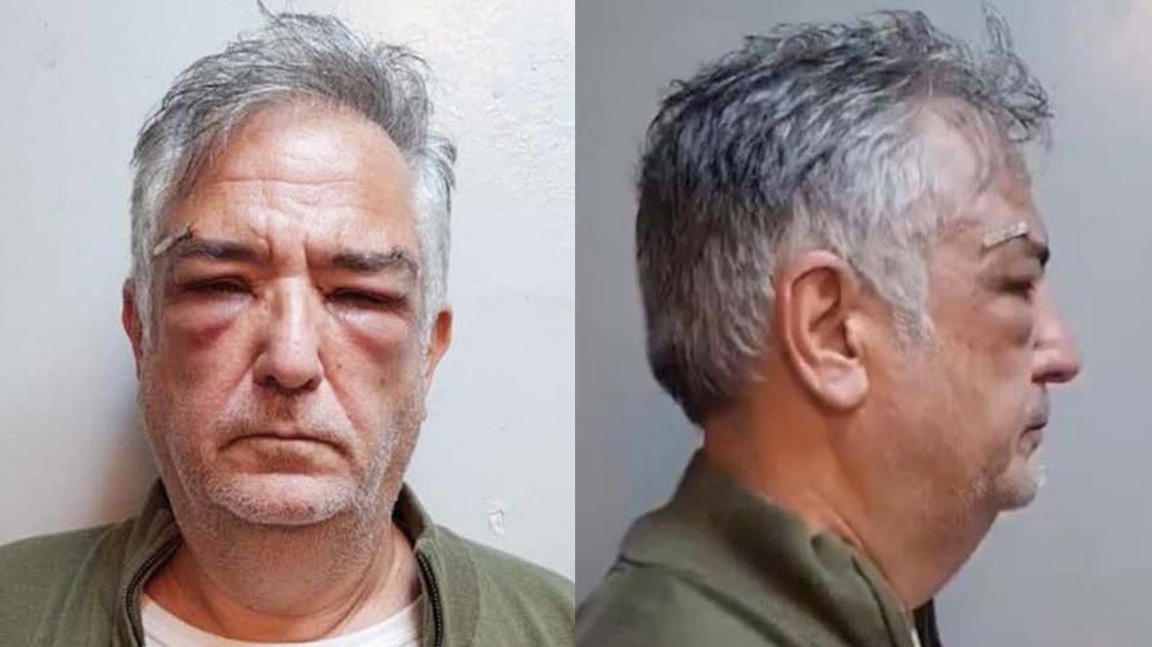 El lado B del caso Calvete: bailarinas, departamentos y explotación sexual