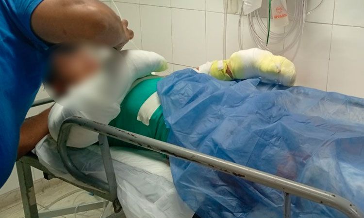 Explotó un celular gamer mientras cargaba y dejó a un adolescente con el 60% del cuerpo quemado