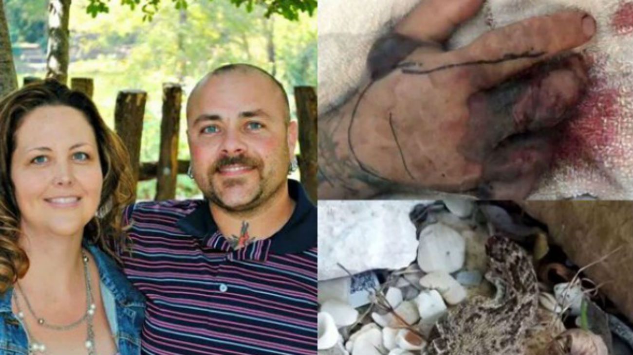 Le cortó la cabeza a una serpiente venenosa, y el animal igual lo mordió