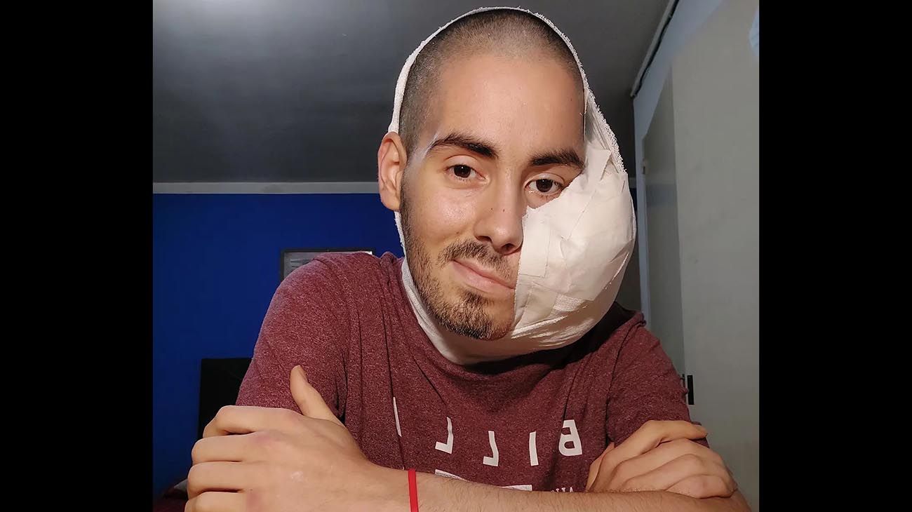 Murió Sebastián Amurín, el joven que luchó durante ocho años contra un extraño tumor en el rostro