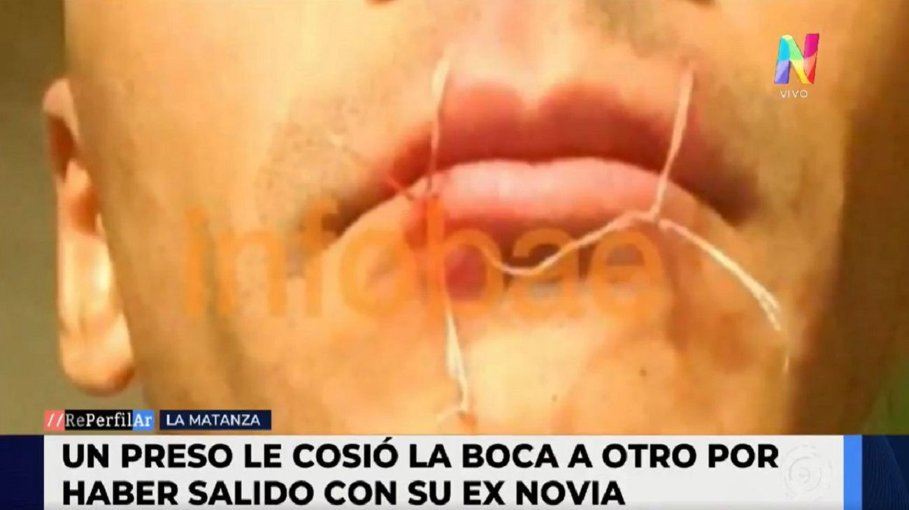 Horror en La Matanza: le cosieron la boca a un preso por celos