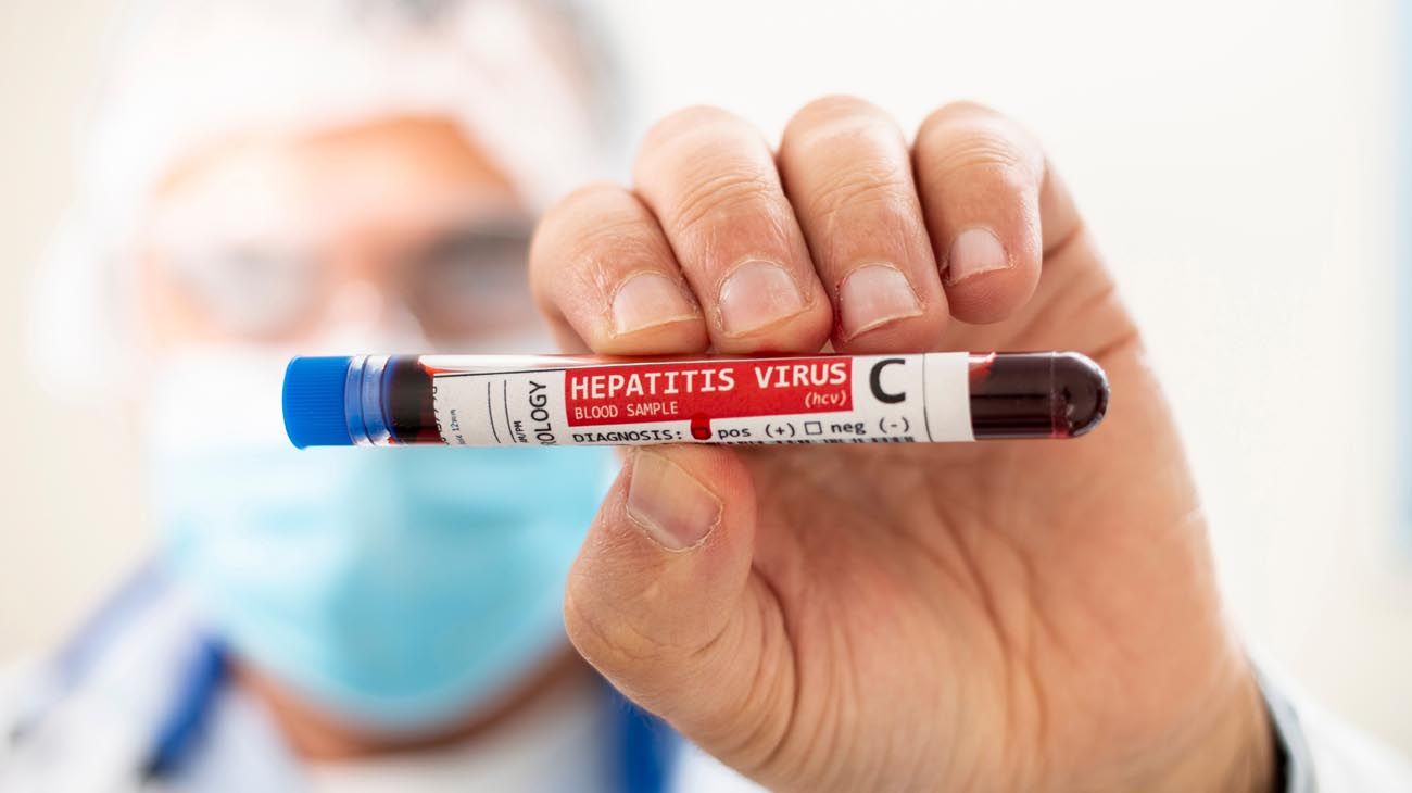 Día Mundial de la Hepatitis | Según una encuesta, el 45% de los pacientes se curaron de la enfermedad