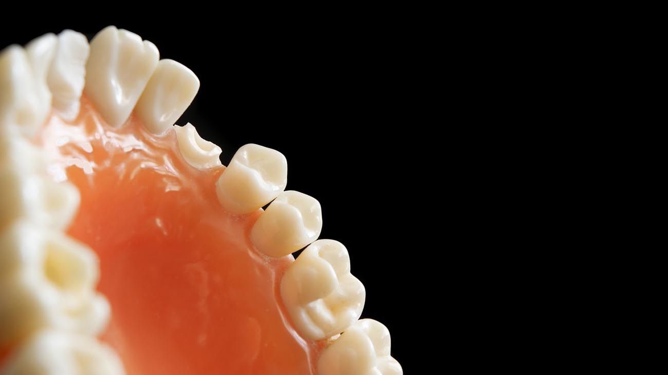Caries: causas, prevención y tratamientos según expertos en salud bucal