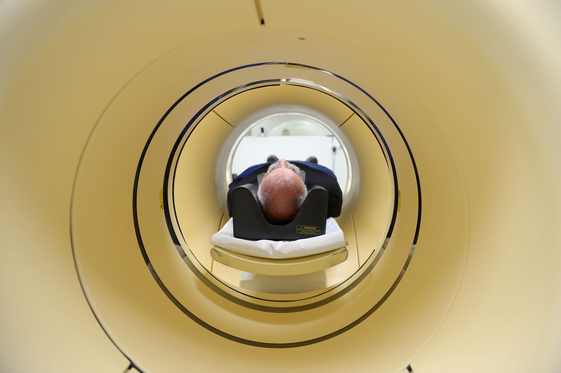 Buscan aprobar una controvertida terapia contra el mal de Alzheimer