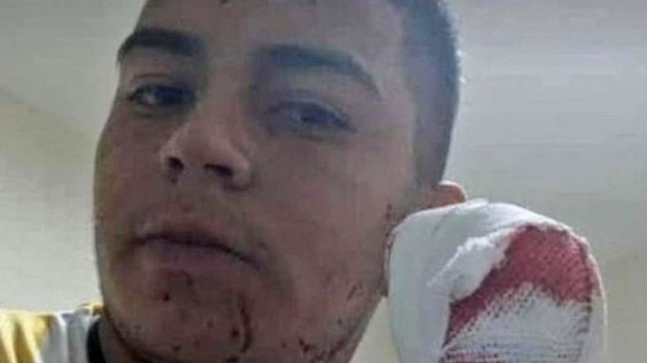 Tucumán: un repartidor perdió cuatro dedos tras ser atacado salvajemente con un machete