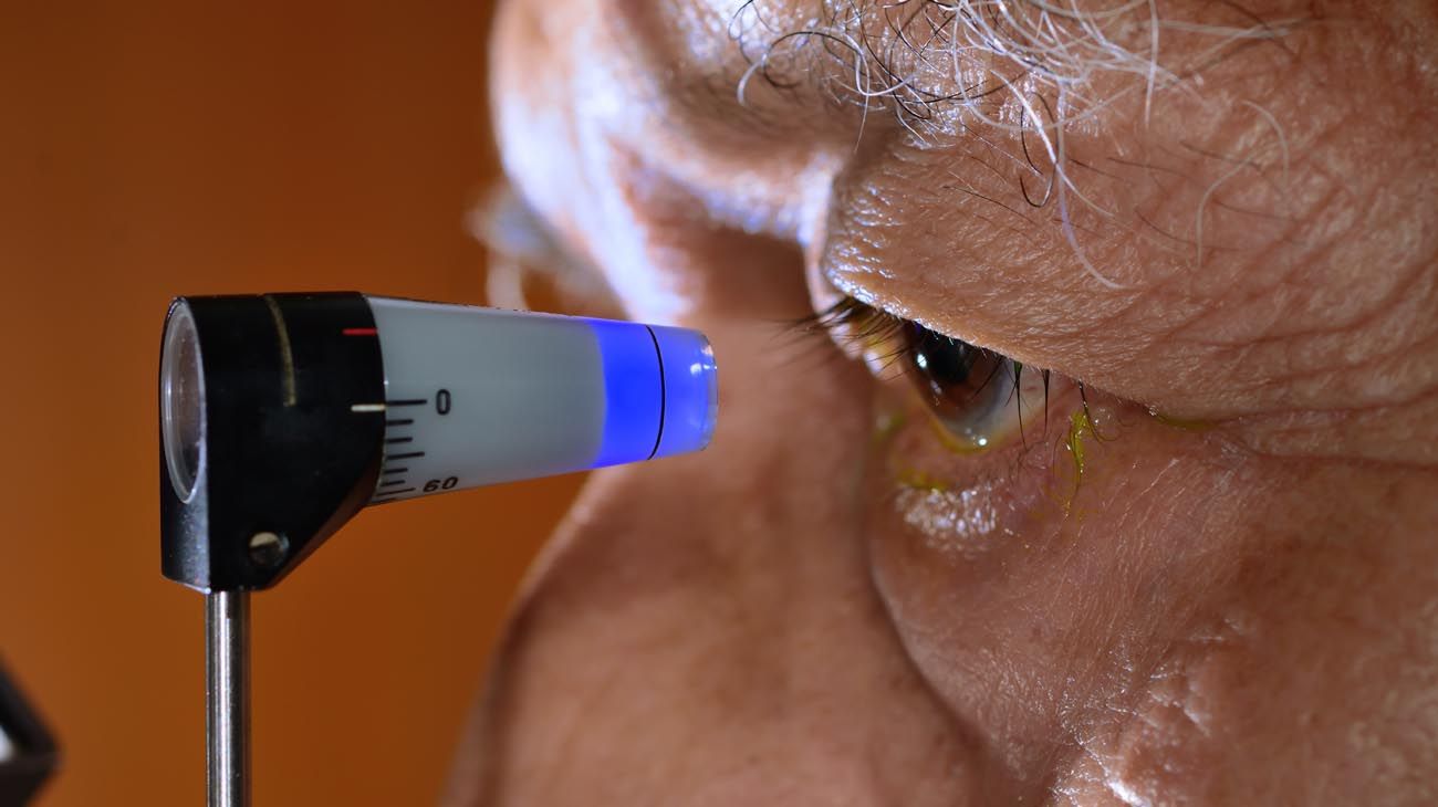 Semana Mundial del Glaucoma: una patología silenciosa, pero totalmente prevenible