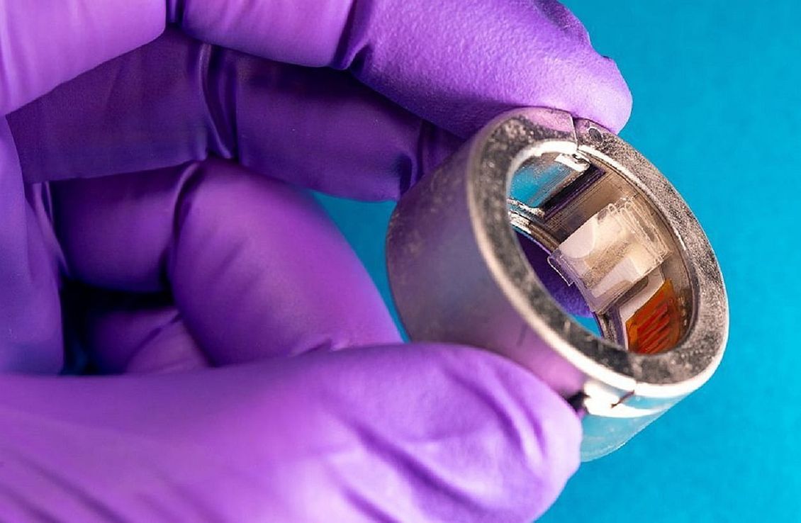Crean un anillo inteligente que mide glucosa, cetonas y otros biomarcadores