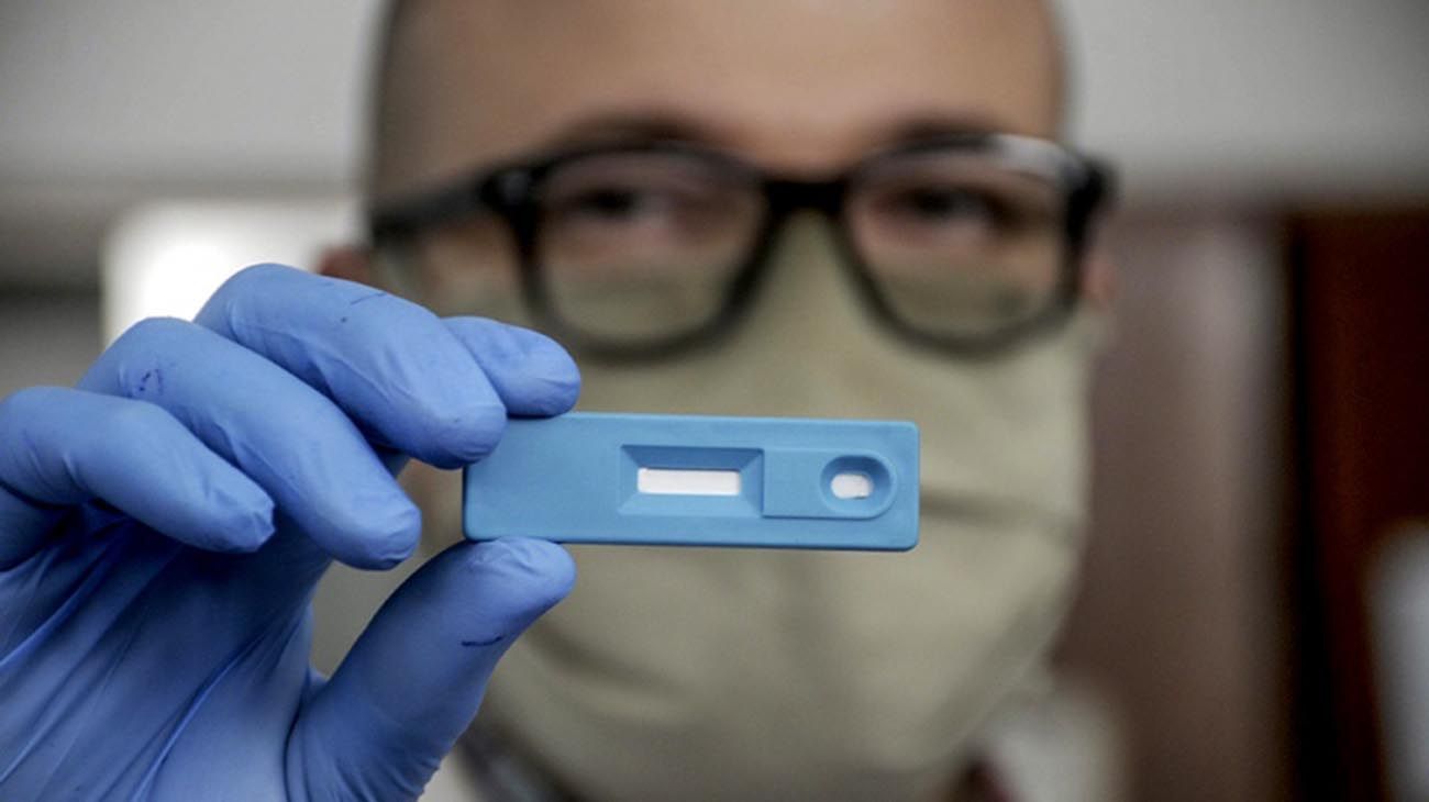 La ANMAT aprobó el FarmaCov, el primer test rápido de coronavirus