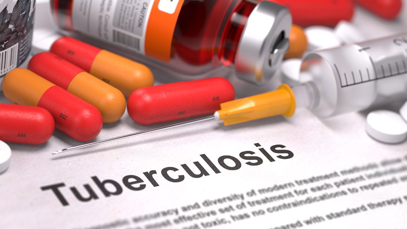Los argumentos morales y económicos para erradicar la tuberculosis