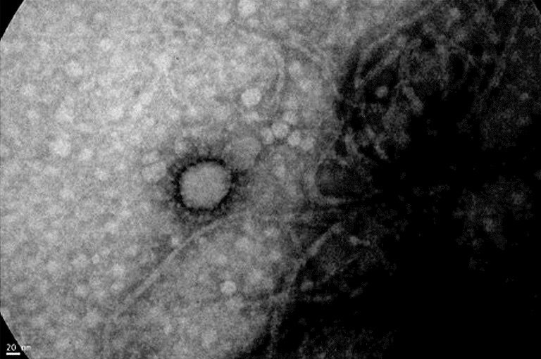 ¿El virus que circula en Argentina es menos agresivo que el de otros países?