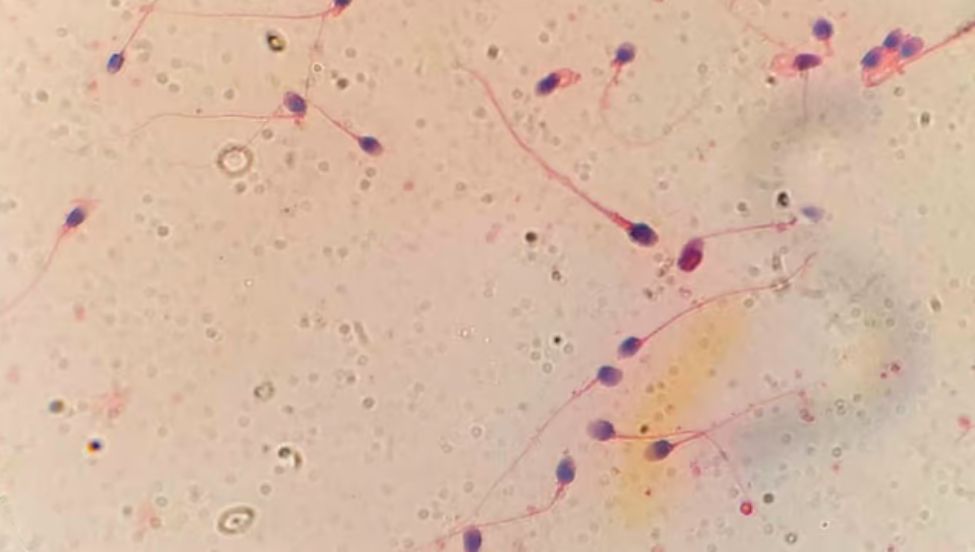 HyperSperm, la innovación argentina que mejora la fertilización in vitro y abre una nueva esperanza para miles de parejas