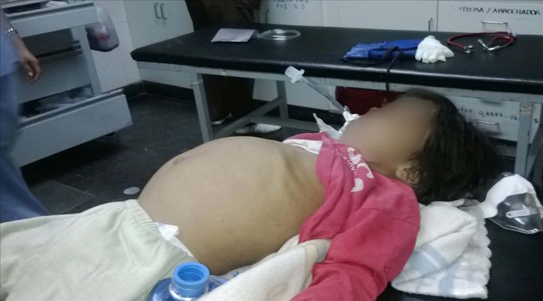 Salta: murió otro chico por la desnutrición