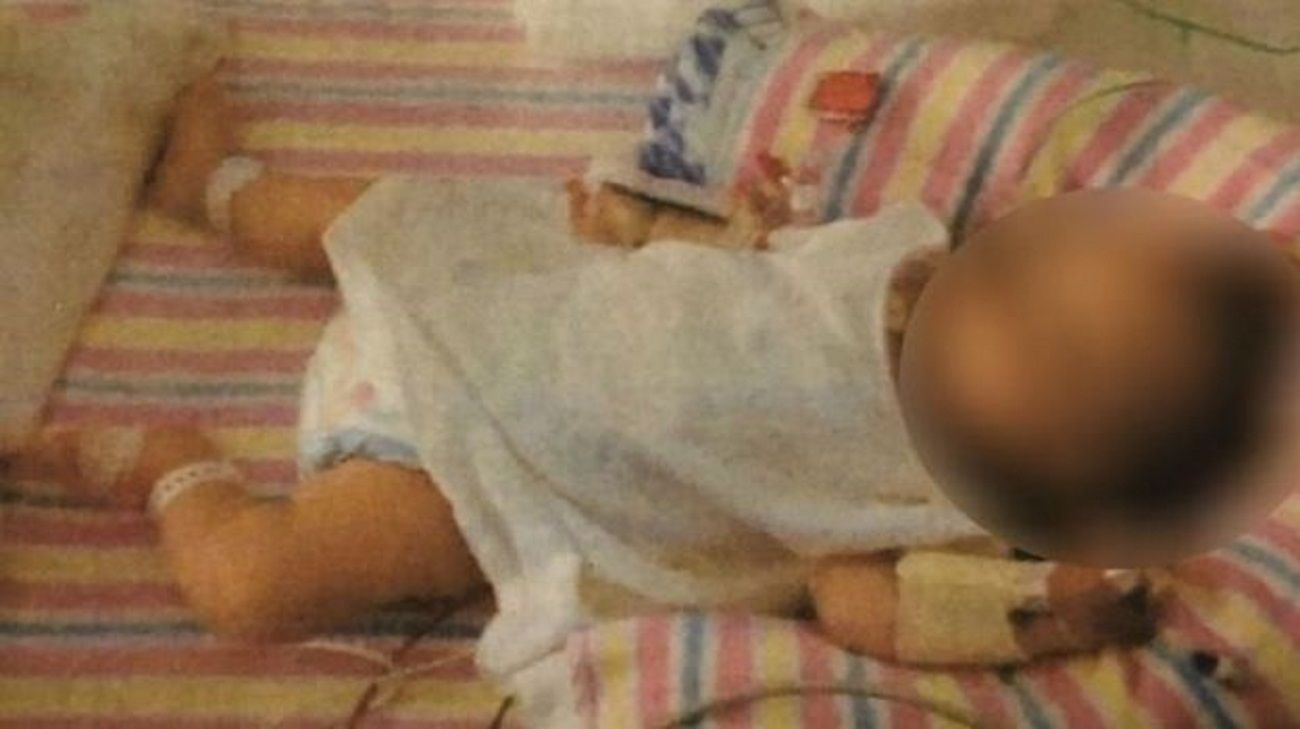 Sometieron a su beba a una dieta vegana, quedó desnutrida y los condenó la justicia