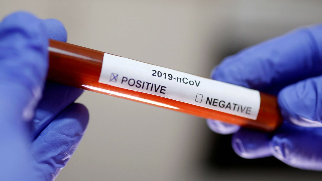 ¿Cómo funciona la prueba rápida del coronavirus?
