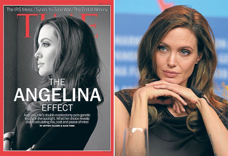 El caso Jolie podría generar mastectomías innecesarias