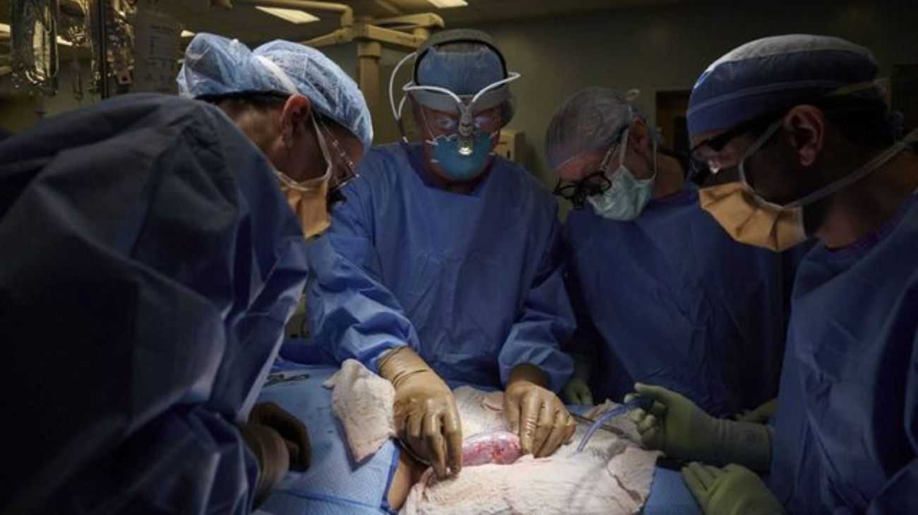 Trasplantaron con éxito el riñón de un cerdo a una mujer con muerte cerebral