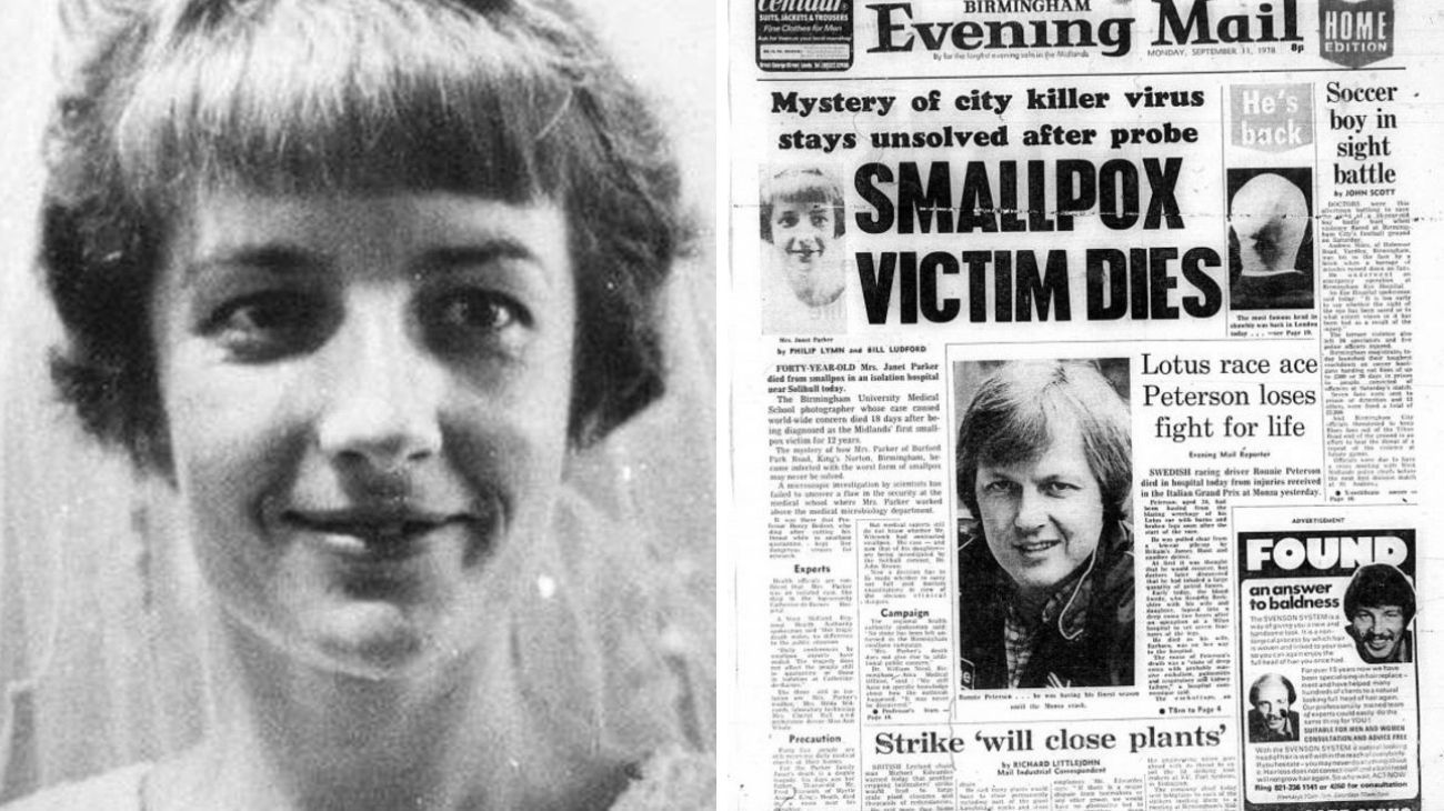 El trágico final de Janet Parker, la última víctima mortal de la viruela en el mundo
