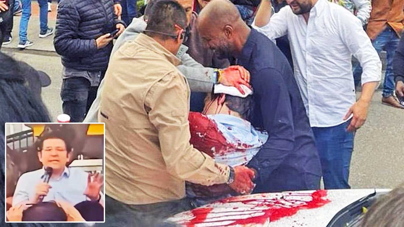 Hieren de un disparo en la cabeza a un precandidato presidencial en Colombia