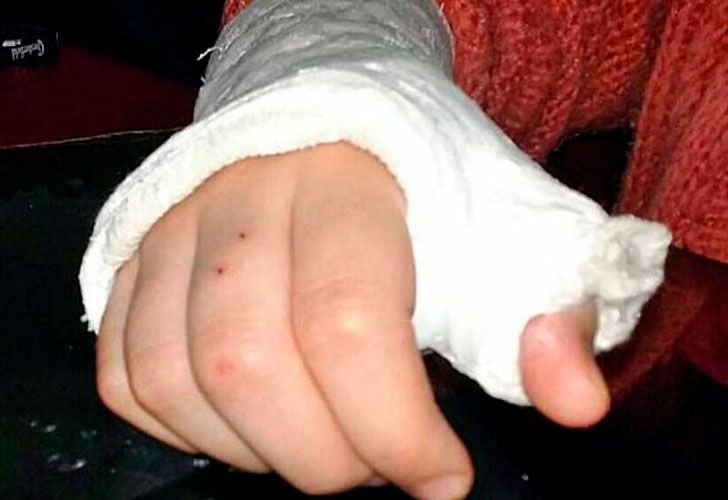 Bullying: torturaron a una nena con lapiceras calientes en Bahía Blanca