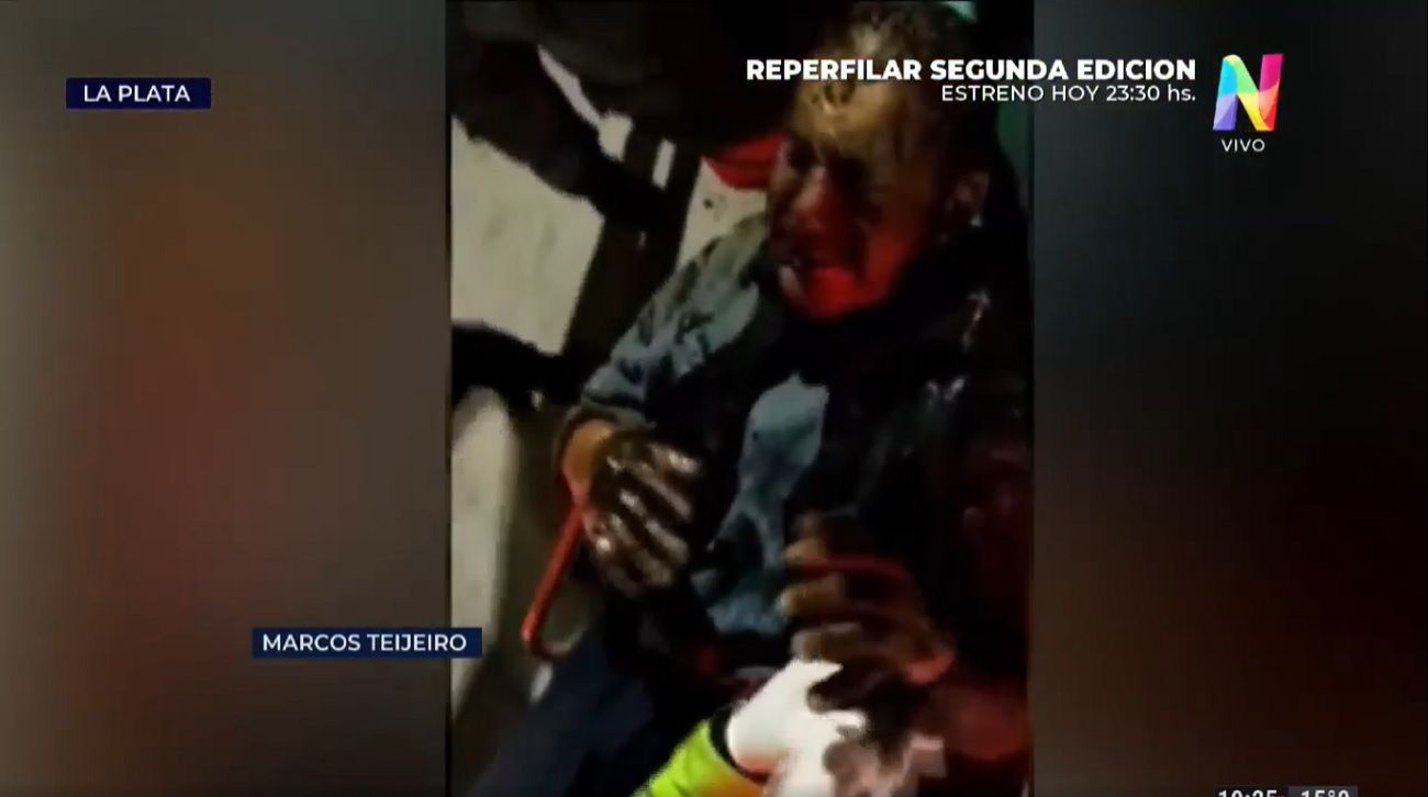 Horror en La Plata: prendieron fuego a un sintecho