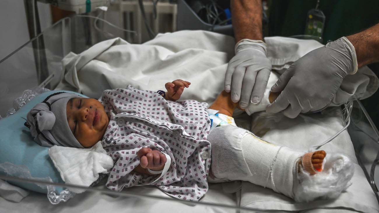 Amina, la bebé recién nacida que sobrevivió a dos disparos en Afganistan