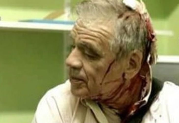 Bazán, tras la agresión en Congreso: "Me impresionó verme bañado en sangre"