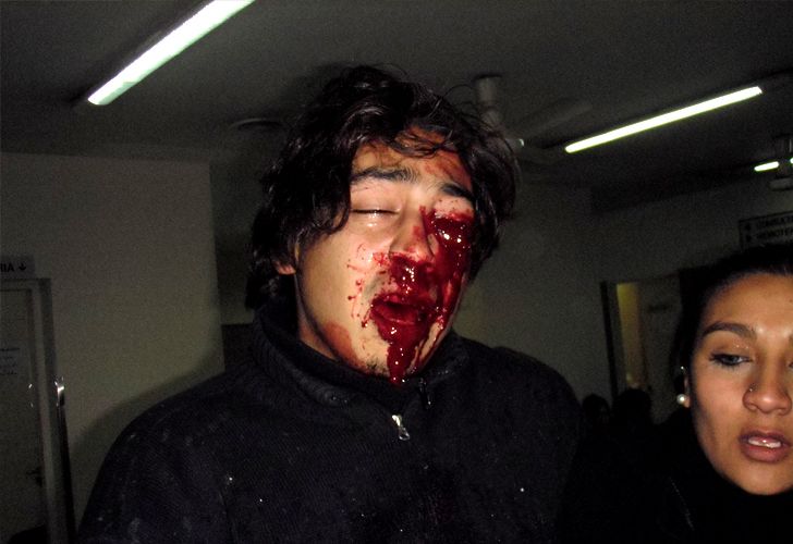 Sangrienta pelea K entre militantes de Scioli y de Ishii