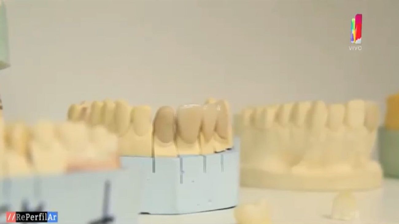 Nueva tecnología: Qué es la ortodoncia en tres dimensiones
