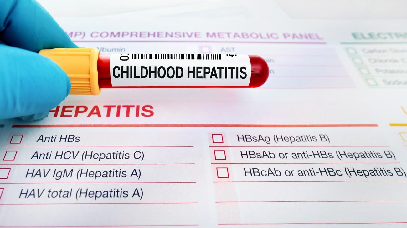 Cuáles son las diferencias entre la nueva hepatitis aguda y las A y B