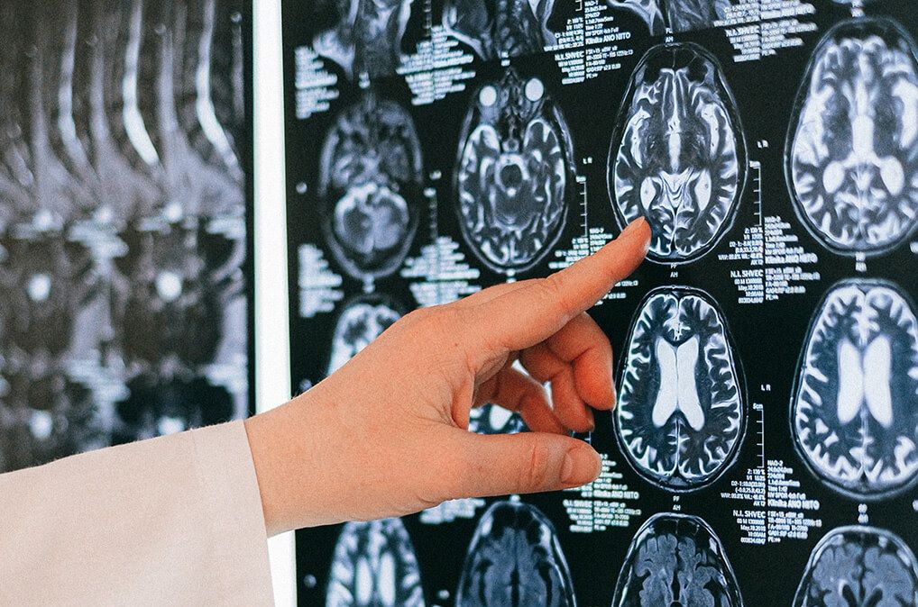 Neurocirujanos suspenden la atención para afiliados de Ioscor: críticas al Gobierno