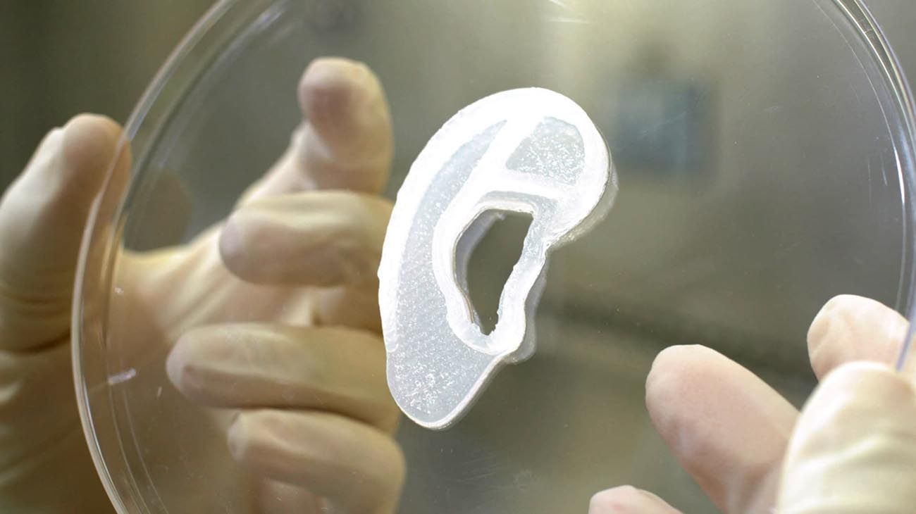 Un cirujano implantó una oreja hecha en una impresora 3D a un paciente