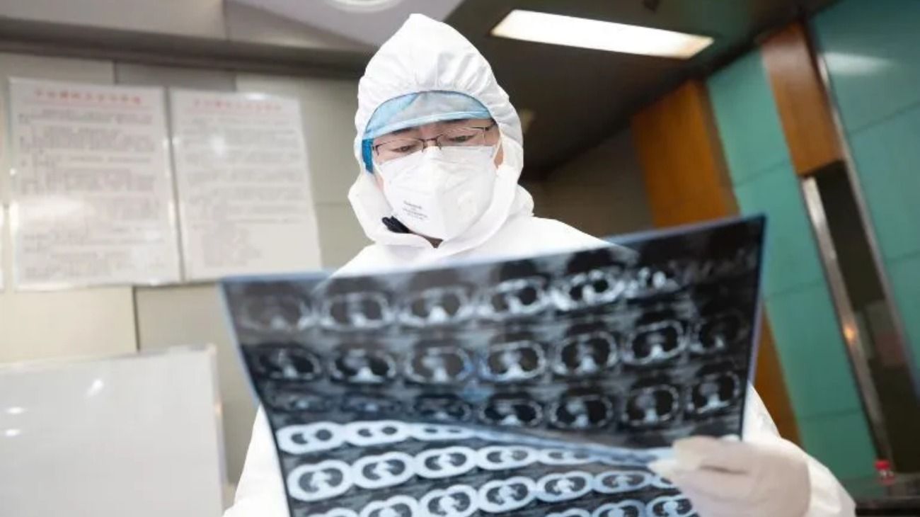 El médico chino que anticipó el Coronavirus murió por esa enfermedad